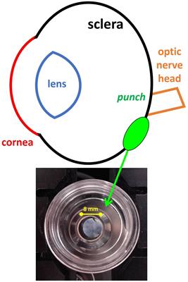 Quantitative structural organization of the sclera in chicks after deprivation myopia measured with second harmonic generation microscopy